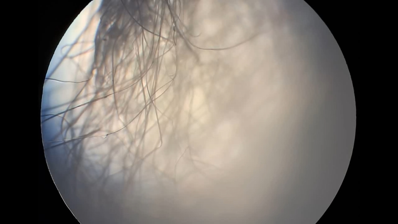 Electrospinning: Solution of Polystyrene in Methylene Chloride